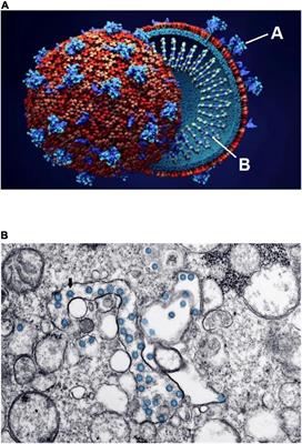 COVID-19 and the Heart: Could Transient Takotsubo Cardiomyopathy Be Related to the Pandemic by Incidence and Mechanisms?